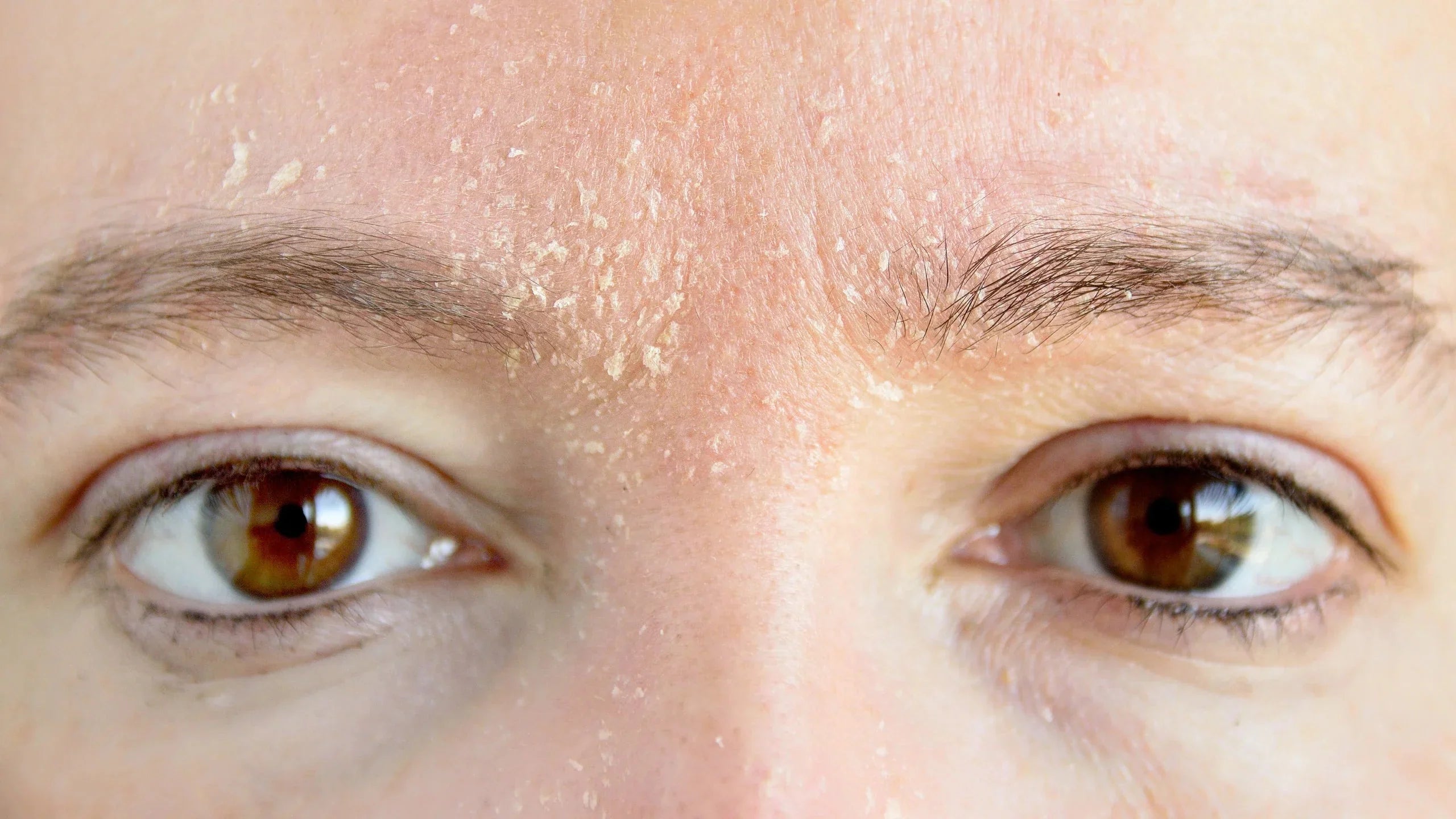 The Biggest Skincare & Perfume Mistakes We See Every Day - ACCEPTANCE
